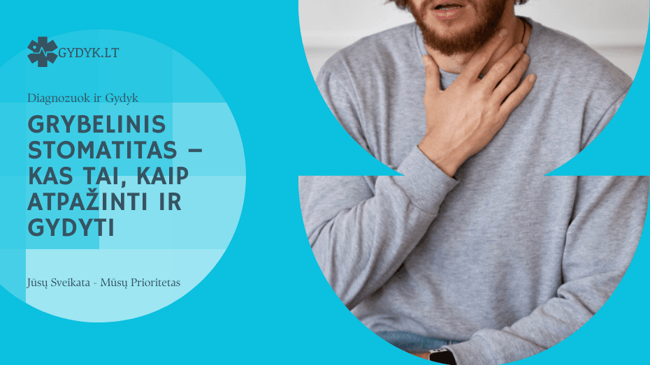 Grybelinis stomatitas – kas tai, kaip atpažinti ir gydyti Grybelinis stomatitas – kas tai, kaip atpažinti ir gydyti