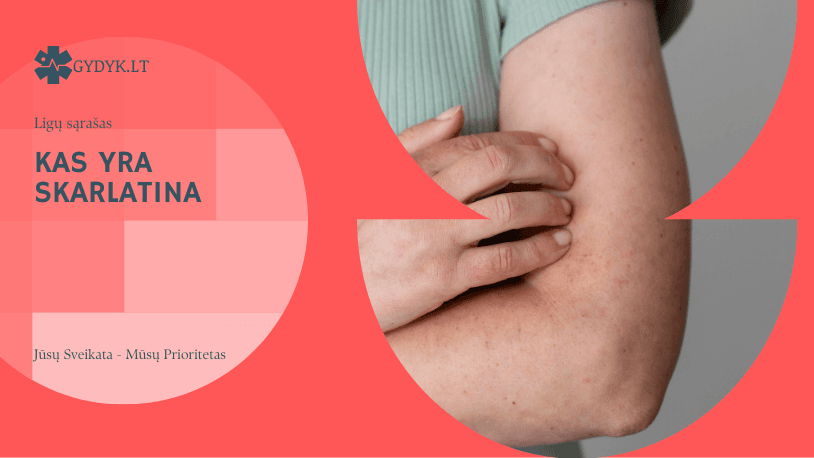 Kas yra skarlatina – pagrindiniai požymiai, bėrimo tipai ir inkubacinis laikotarpis Kas yra skarlatina – pagrindiniai požymiai, bėrimo tipai ir inkubacinis laikotarpis