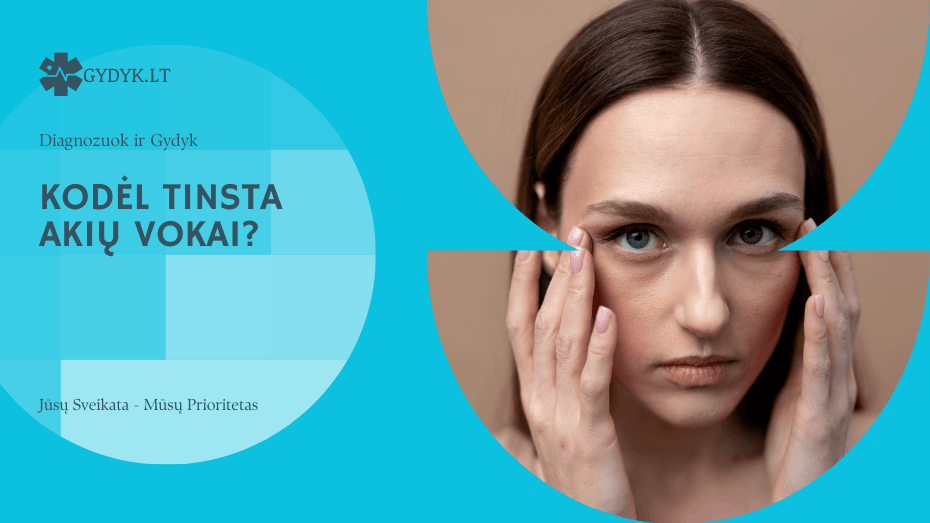 Kodėl tinsta akių vokai? Kodėl tinsta akių vokai?