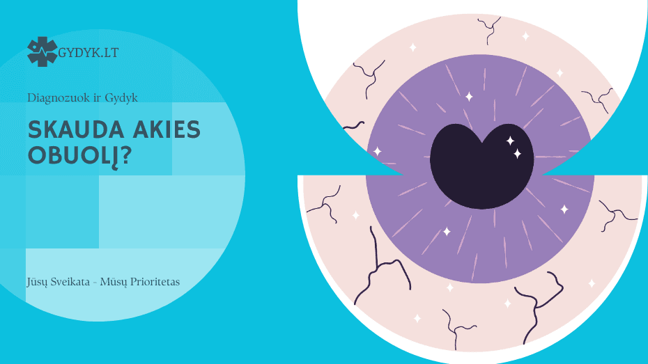 skauda akies obuolį