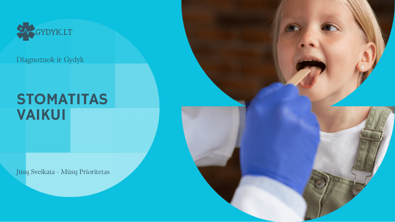 Stomatitas vaikui – pagrindinės priežastys, pirmieji simptomai ir veiksmingas gydymas Stomatitas vaikui – pagrindinės priežastys, pirmieji simptomai ir veiksmingas gydymas