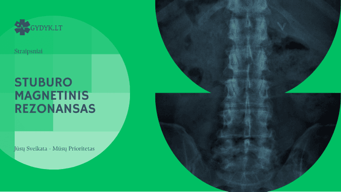 Stuburo magnetinis rezonansas: kaip atliekamas, kiek laiko trunka ir kaip pasiruošti?