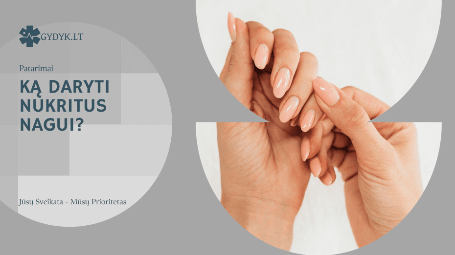 Ką daryti nukritus nagui