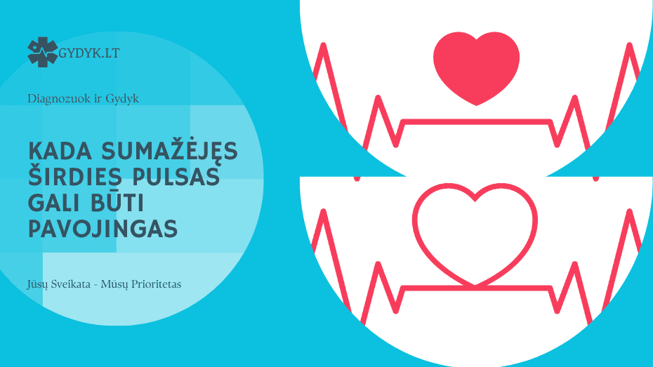 Kada sumažėjęs širdies pulsas gali būti pavojingas