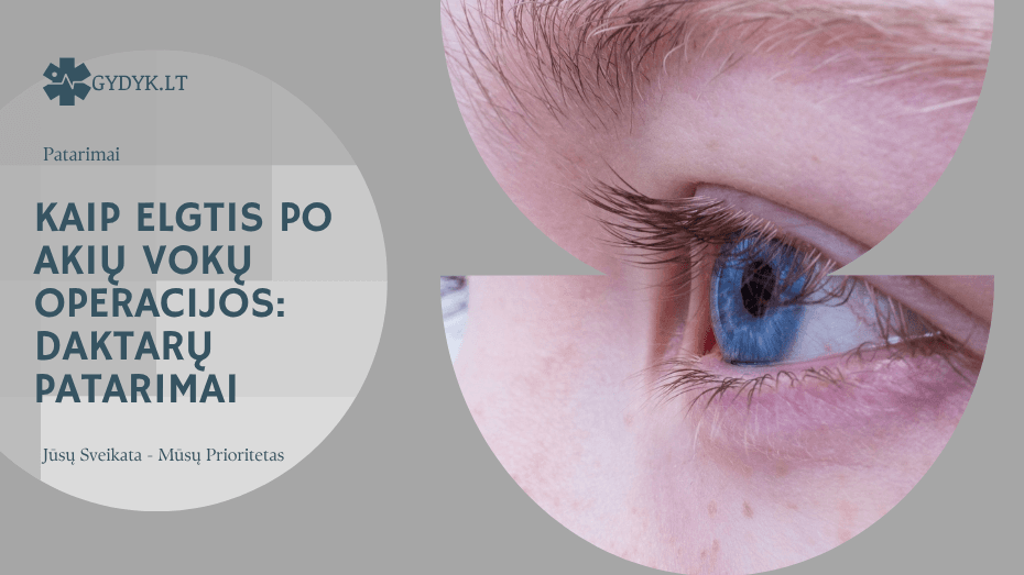 Kaip elgtis po akių vokų operacijos daktarų patarimai