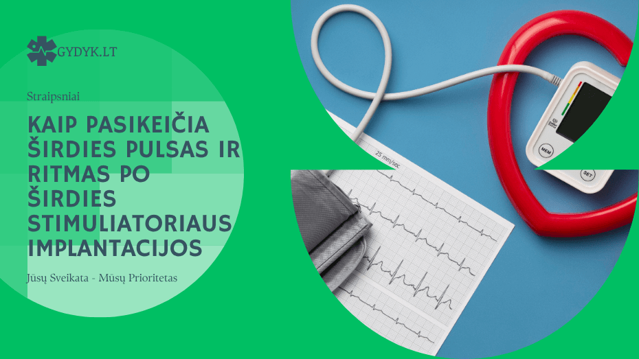 Kaip pasikeičia širdies pulsas ir ritmas po širdies stimuliatoriaus implantacijos