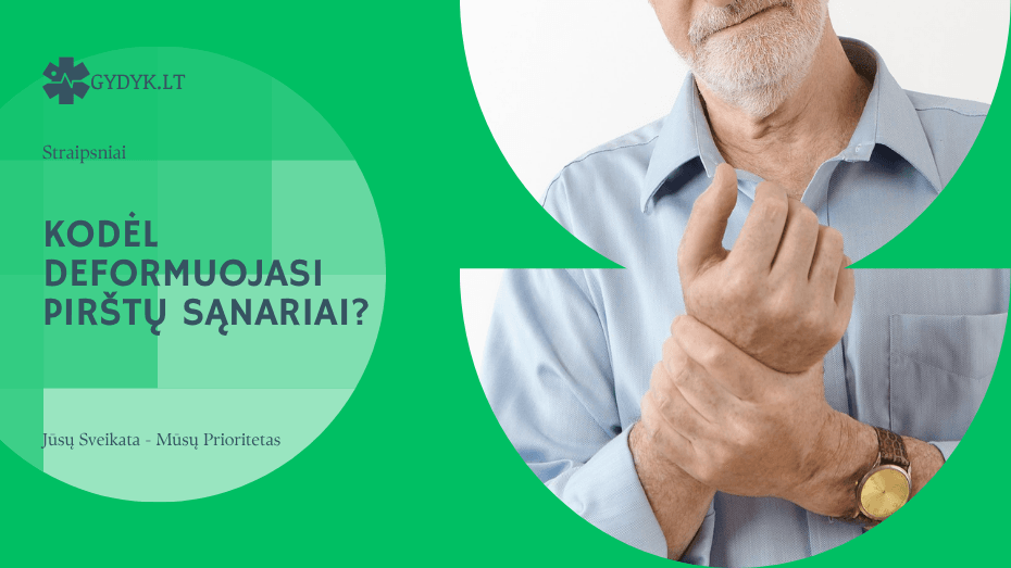 Kodėl deformuojasi pirštų sąnariai? Kodėl deformuojasi pirštų sąnariai
