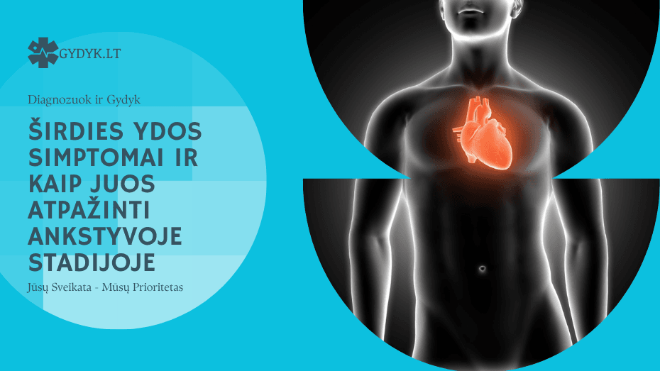 Širdies ydos simptomai ir kaip juos atpažinti ankstyvoje stadijoje Širdies ydos simptomai ir kaip juos atpažinti ankstyvoje stadijoje
