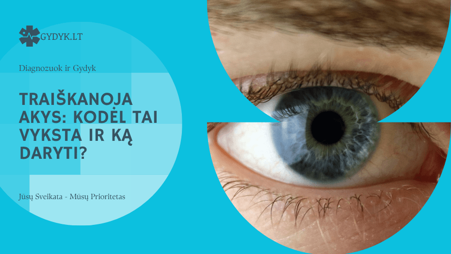 Traiškanoja akys: kodėl tai vyksta ir ką daryti?
