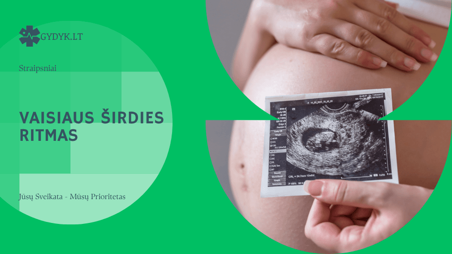 Vaisiaus širdies ritmas