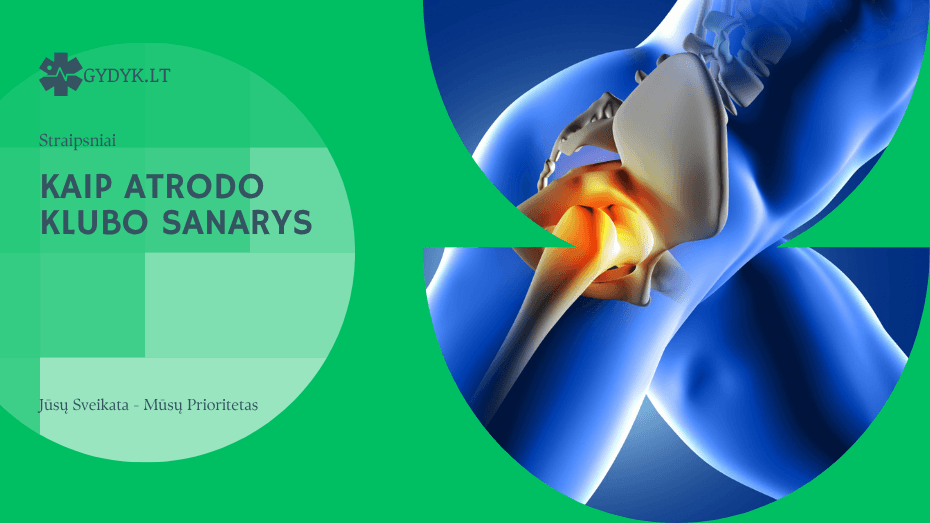 kaip atrodo klubo sanarys