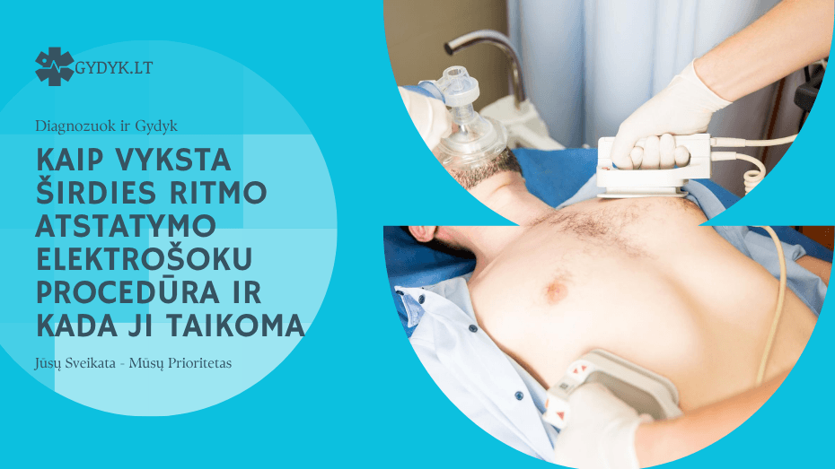 Kaip vyksta širdies ritmo atstatymo elektrošoku procedūra ir kada ji taikoma