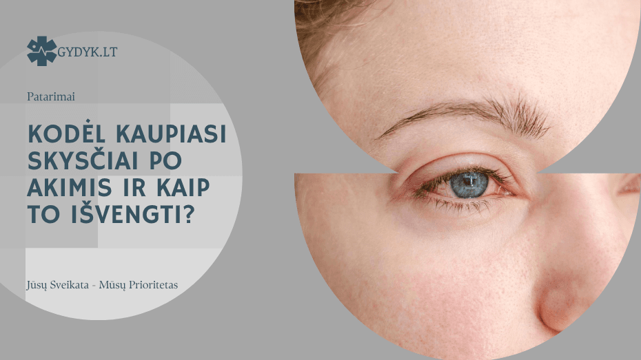 Kodėl kaupiasi skysčiai po akimis ir kaip to išvengti? Kodėl kaupiasi skysčiai po akimis ir kaip to išvengti?