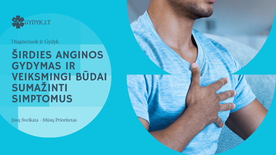 Širdies anginos gydymas ir veiksmingi būdai sumažinti simptomus