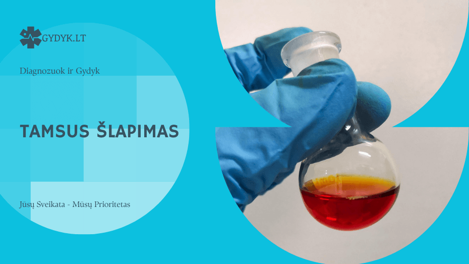 Tamsus šlapimas: pagrindinės priežastys ir ką tai reiškia jūsų sveikatai