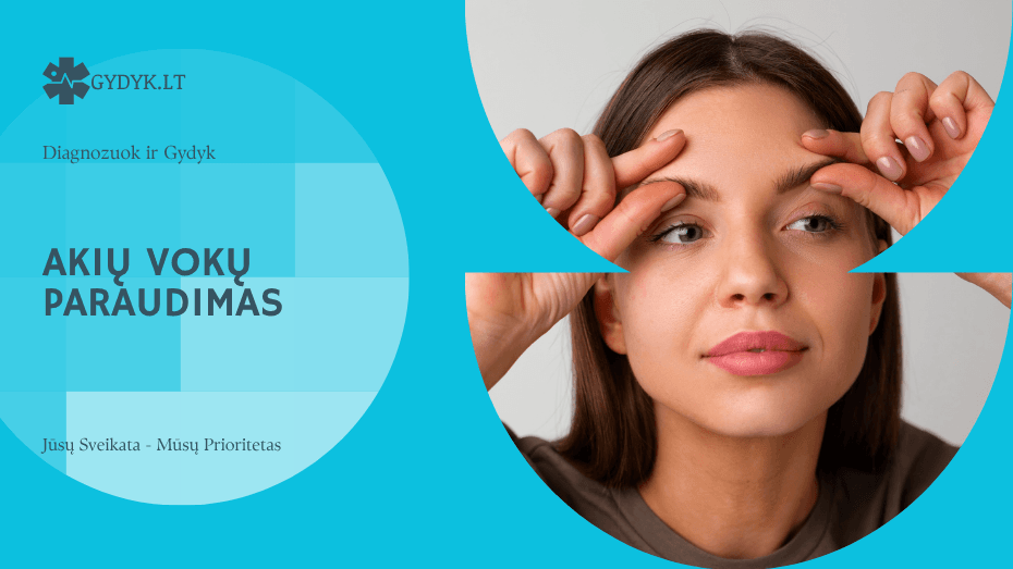 Akių vokų paraudimas