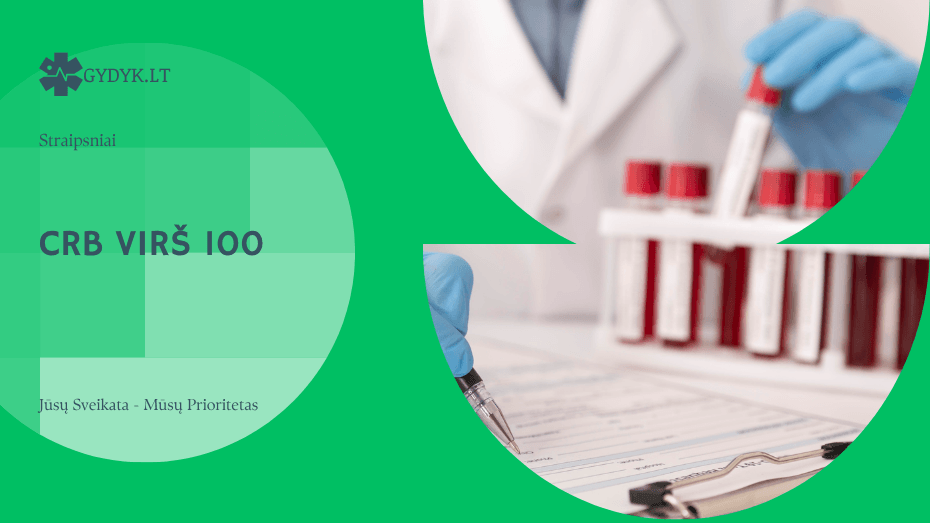 CRB virš 100