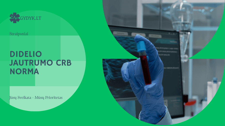 Didelio jautrumo CRB norma
