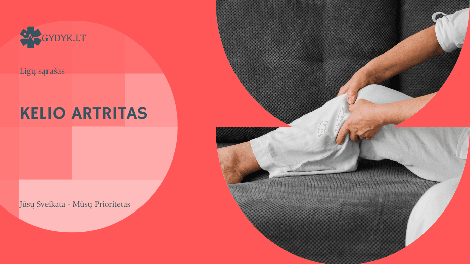 Kelio artritas: simptomai, tyrimai ir gydymo galimybės Kelio artritas: simptomai, tyrimai ir gydymo galimybės