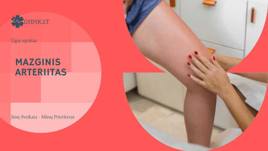 Mazginis arteriitas: simptomai, tyrimai ir gydymo galimybės Mazginis arteriitas