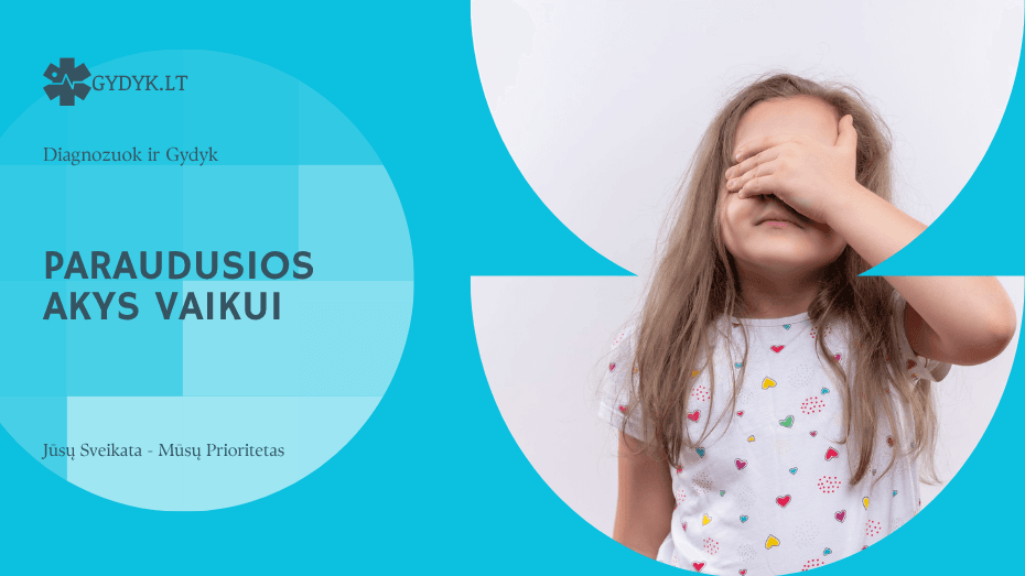 Paraudusios akys vaikui