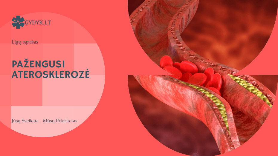 Pažengusi aterosklerozė