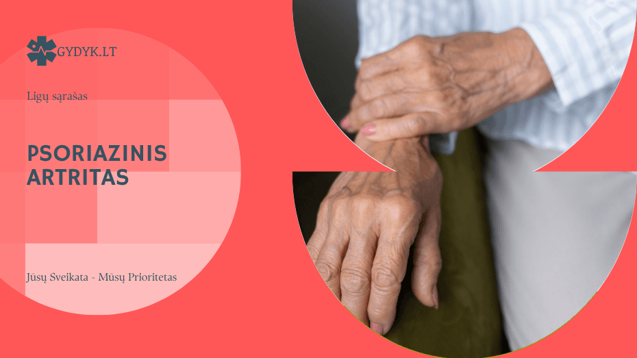 Psoriazinis artritas: kai odos liga pažeidžia sąnarius Psoriazinis artritas