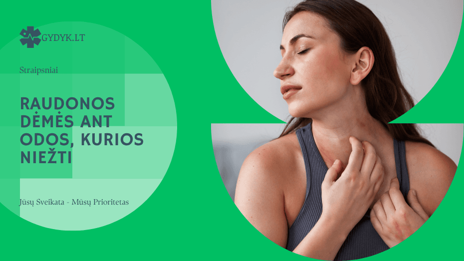 Raudonos dėmės ant odos, kurios niežti – kada sunerimti ir kreiptis į gydytoją Raudonos dėmės ant odos, kurios niežti