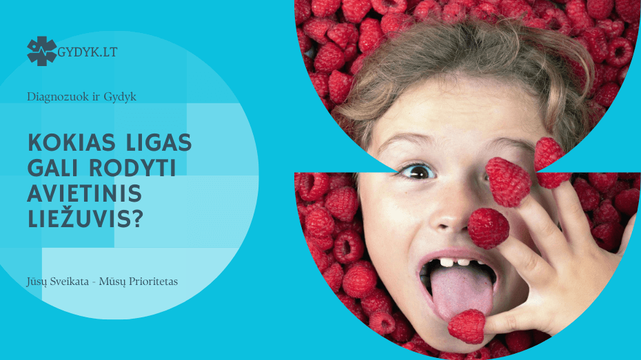 Avietinis liežuvis: kokias ligas gali rodyti šis simptomas? kokias ligas gali rodyti avietinis liežuvis
