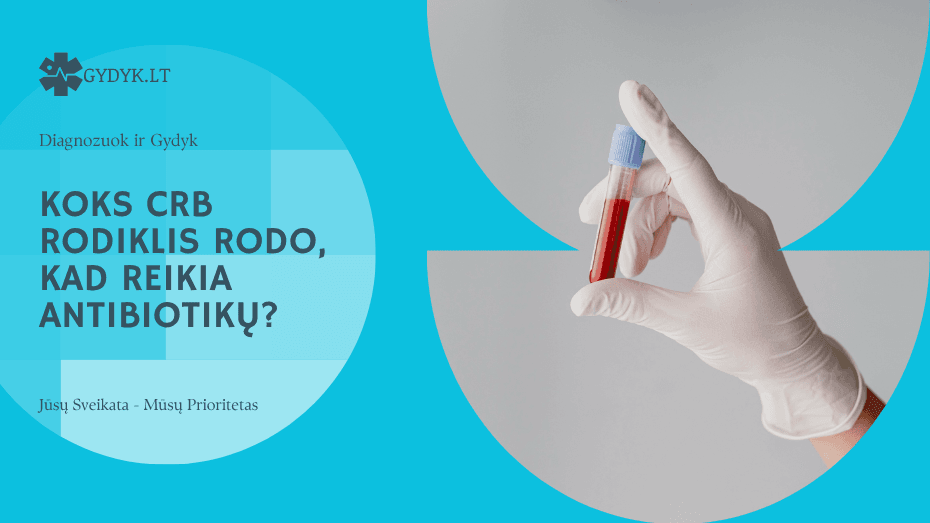 Koks CRB rodiklis rodo, kad reikia antibiotikų? Gydytojų paaiškinimas Koks CRB rodiklis rodo, kad reikia antibiotikų? Gydytojų paaiškinimas