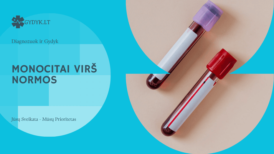 Monocitai virš normos: ką rodo kraujo tyrimo rezultatai? Monocitai virš normos: ką rodo kraujo tyrimo rezultatai?