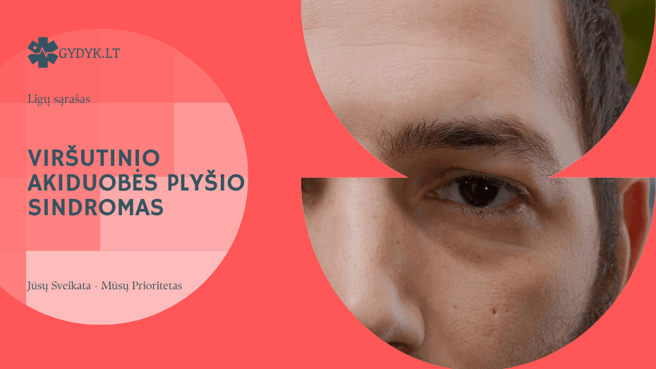 Viršutinio akiduobės plyšio sindromas: priežastys, simptomai ir gydymas