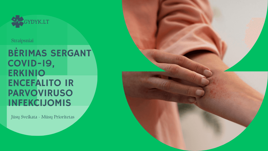 Bėrimas sergant COVID-19, erkinio encefalito ir parvoviruso infekcijomis