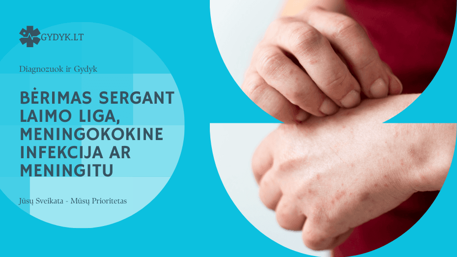 Bėrimas sergant Laimo liga, meningokokine infekcija ar meningitu