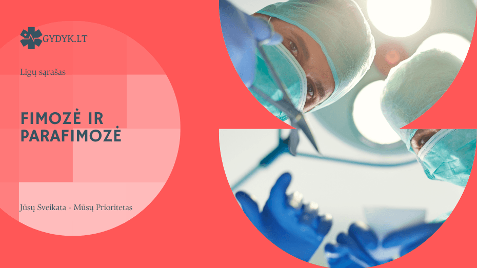Fimozė ir parafimozė: simptomai, komplikacijos ir gydymo galimybės Fimozė ir parafimozė: simptomai, komplikacijos ir gydymo galimybės