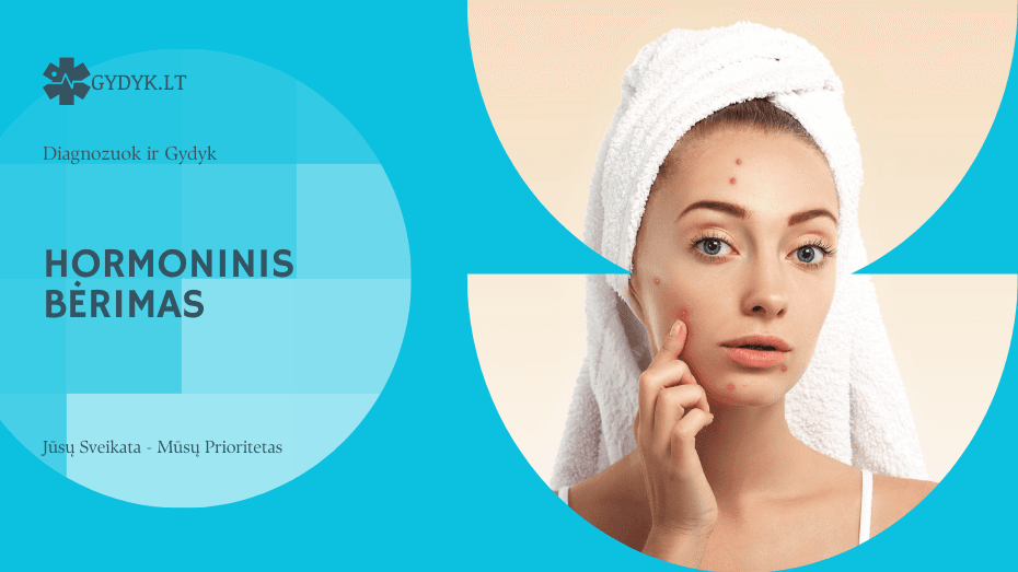 Hormoninis bėrimas: kodėl jis atsiranda ir kaip jį suvaldyti