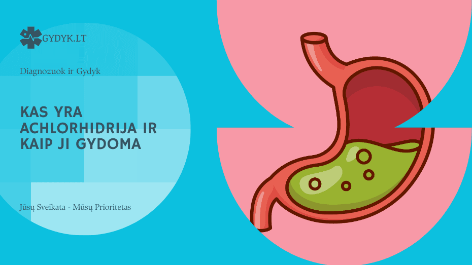 Kas yra achlorhidrija ir kaip ji gydoma