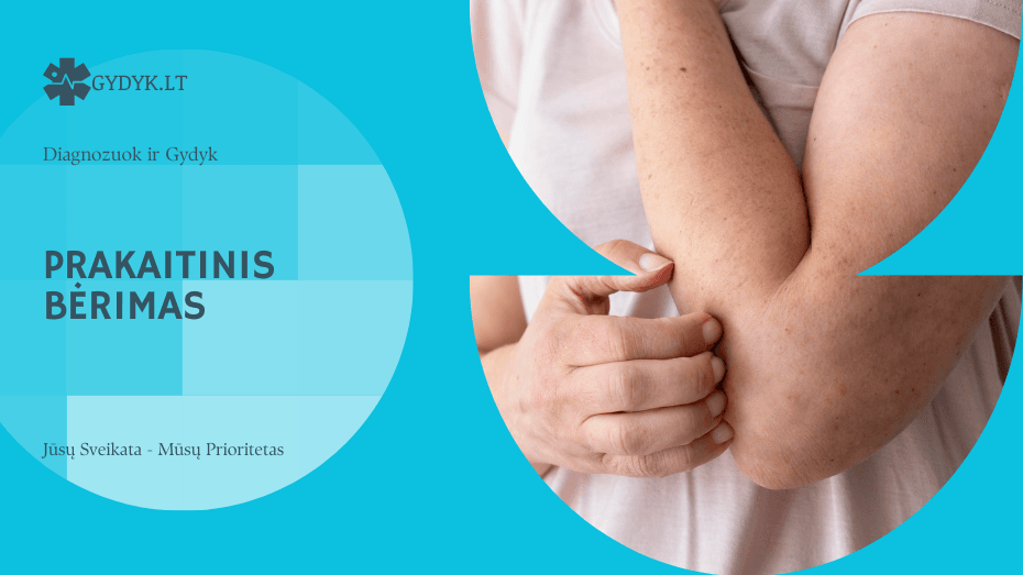 Prakaitinis bėrimas