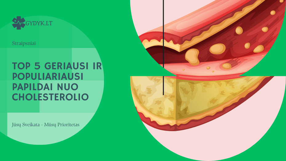 TOP 5 geriausi ir populiariausi papildai nuo cholesterolio