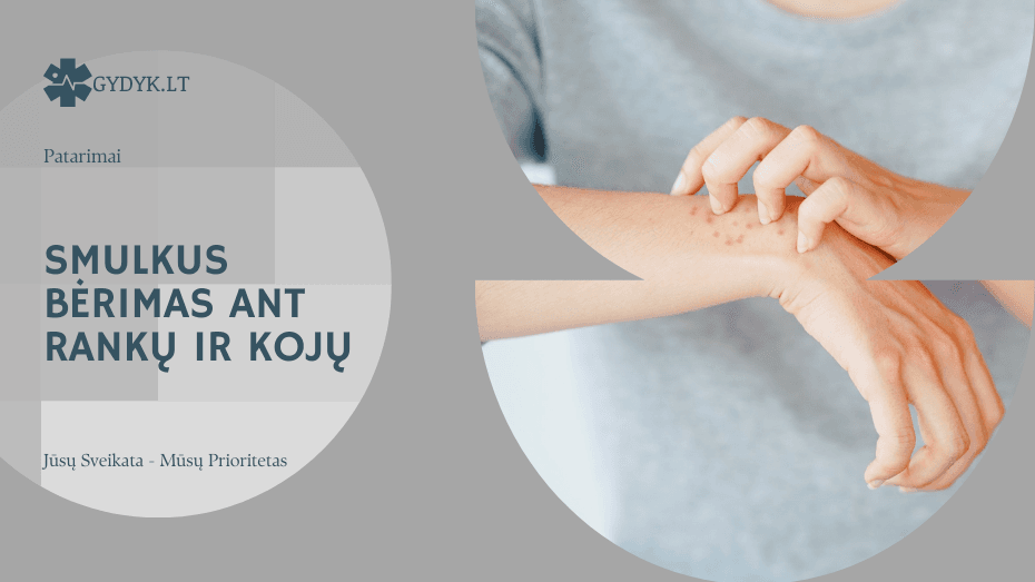 Smulkus bėrimas ant rankų ir kojų: ką jis reiškia?