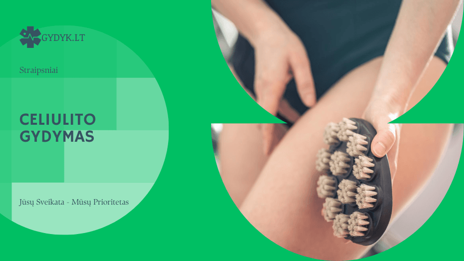 Celiulito gydymas: kas iš tikrųjų veikia? Celiulito gydymas: kas iš tikrųjų veikia?