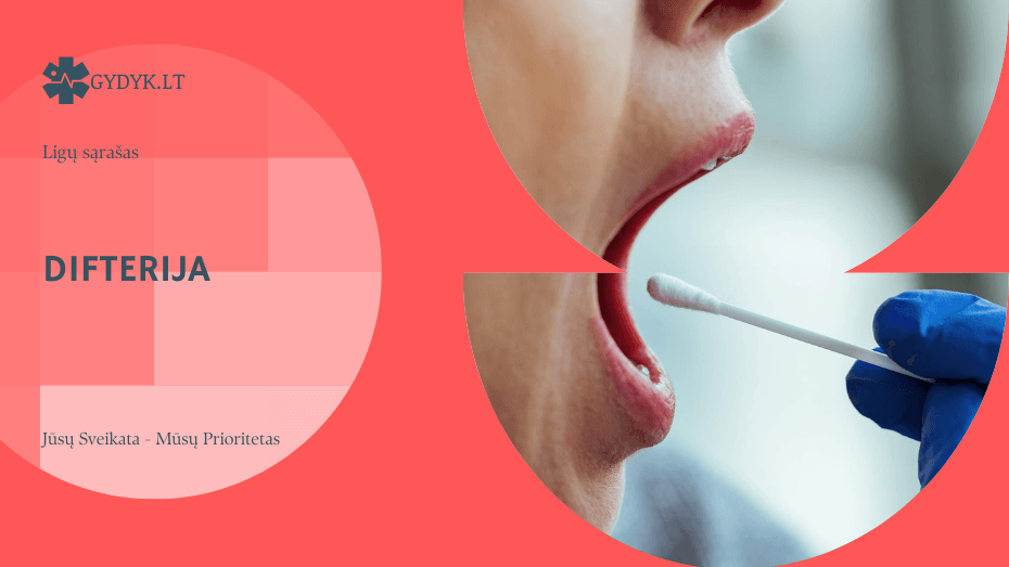 Difterija