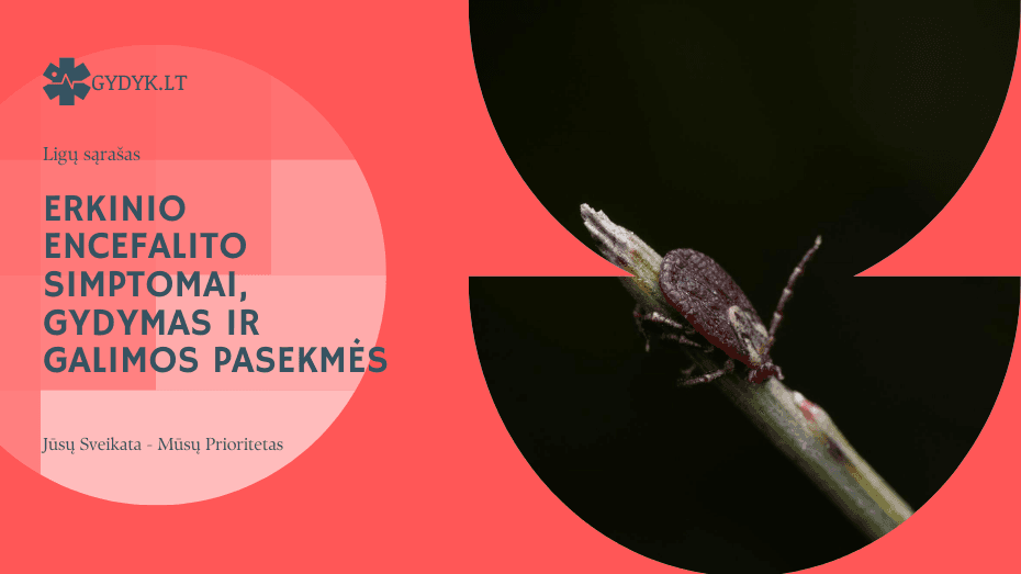 Erkinio encefalito simptomai, gydymas ir galimos pasekmės