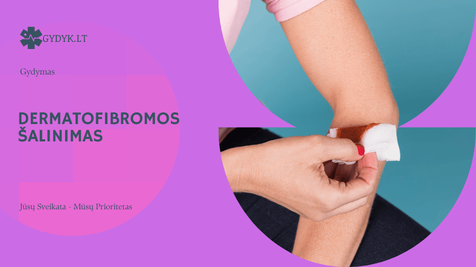 Dermatofibromos šalinimas: kada reikia, kaip atliekama ir ko tikėtis po procedūros