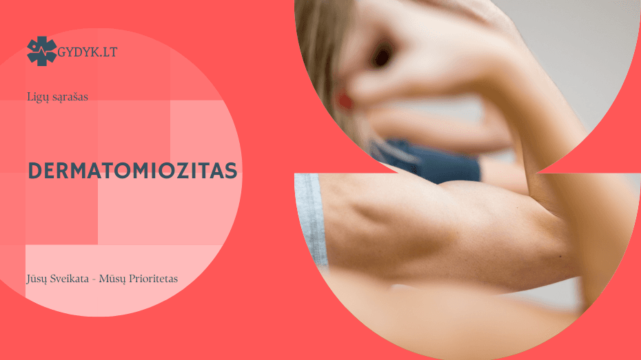 Dermatomiozitas: kas tai, kokie simptomai ir kokios galimos pasekmės