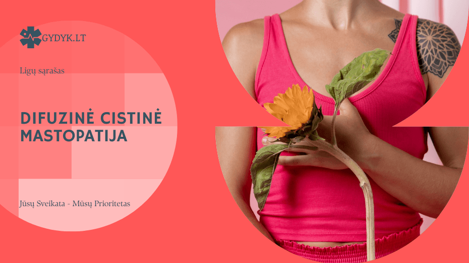 Difuzinė cistinė mastopatija: kas tai, simptomai ir kada reikia sunerimti Difuzinė cistinė mastopatija: kas tai, simptomai ir kada reikia sunerimti