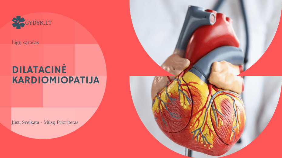 Dilatacinė kardiomiopatija: kas tai, simptomai ir gydymo galimybės Dilatacinė kardiomiopatija: kas tai, simptomai ir gydymo galimybės