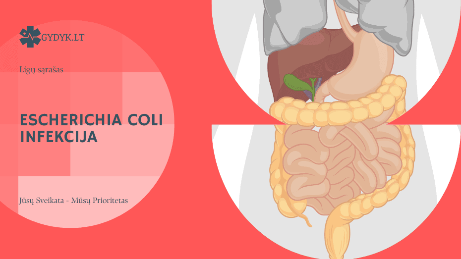 Escherichia coli infekcija: priežastys, simptomai ir gydymas Escherichia coli infekcija: priežastys, simptomai ir gydymas