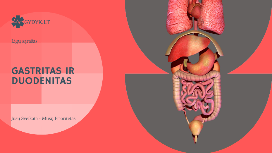 Gastritas ir duodenitas: ar šios ligos gali būti susijusios?
