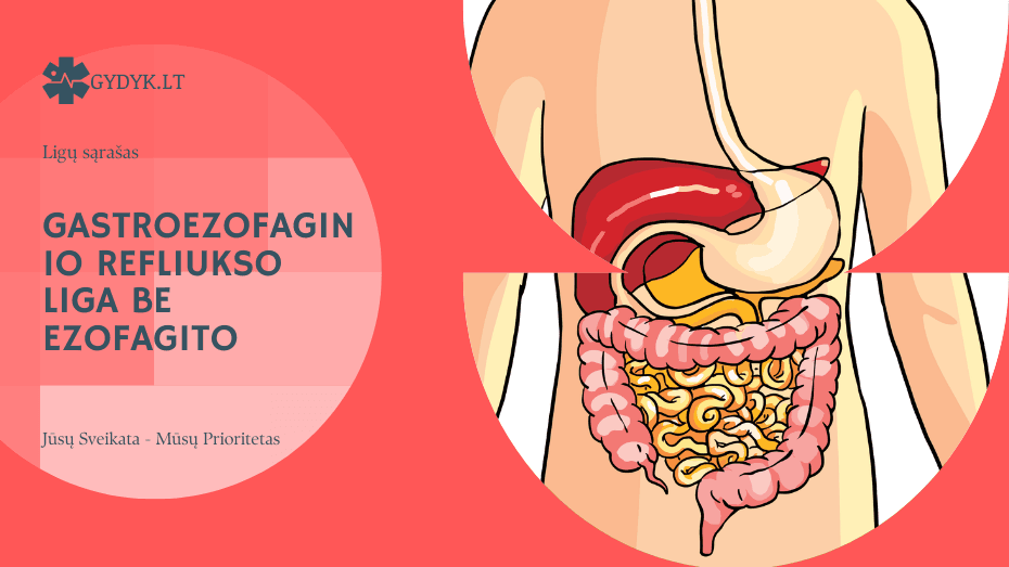 Gastroezofaginio refliukso liga be ezofagito: kas tai, simptomai ir gydymas Gastroezofaginio refliukso liga be ezofagito: kas tai, simptomai ir gydymas